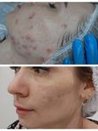 Результат за 5 посещений