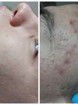Результат за 2 посещения