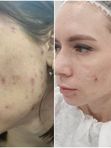 Результат за 5 посещений