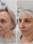Результат за 1 посещение