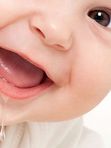 Профессиональная Гигиена полости рта