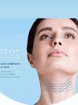 Нитевой лифтинг APTOS