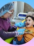 Герметизация фиссур
