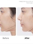 MEDICUBE Гаджет для домашнего ухода за кожей 6-в-1 в розовом цвете AGE-R Booster Pro, 1шт