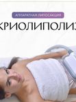 Криолиполиз