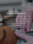 Биоревитализация