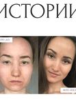 КАК ИЗБАВИТЬСЯ ОТ СЕДИНЫ