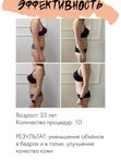 Magic Shape – 4 технологии в одном аппарате