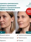 Крем для лица на основе ЖИВОГО КОЛЛАГЕНА. Увлажнение и лифтинг, 75 мл