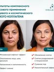 Биоактивная сыворотка для лица на основе ЖИВОГО КОЛЛАГЕНА. Увлажнение и лифтинг, 16 ампул по 2,5 мл