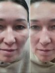Усиливающие процедуры