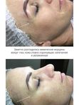 Экспресс омоложение - мышечная маска  Elysien Multi Ex-Lifting