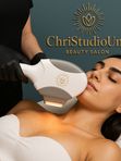 IPL фототерапия декольте