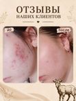 Мыло с эфирными маслами • акне • аллергия •опрелости
