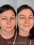 Коррекция перманентного макияжа бровей (через 1-2 месяца)