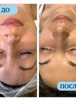 Косметическая кожа