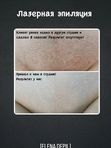 Лазерная эпиляция бикини