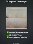 Лазерная эпиляция бикини