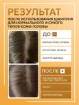 Шампунь для жирного типа кожи головы