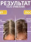 Шампунь для жирного типа кожи головы
