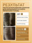 Шампунь для жирного типа кожи головы