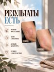 ПСОРИАЗУ НЕТ