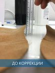 Коррекция ортопедических стелек