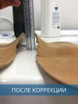 Коррекция ортопедических стелек