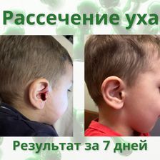 Лекол