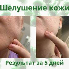 Лекол