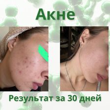 Лекол