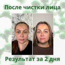 Лекол