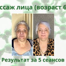 Лекол