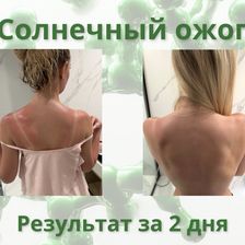 Лекол