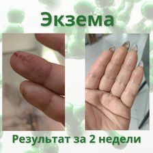 Лекол