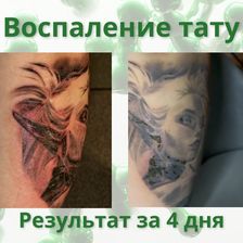 Лекол