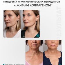 ПЕРВЫЙ ЖИВОЙ КОЛЛАГЕН. ПРОИЗВОДИТЕЛЬ