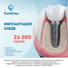 СитиСтом