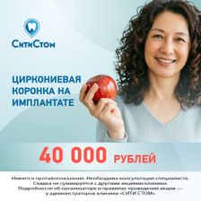 СитиСтом