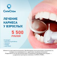 СитиСтом