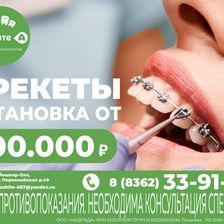 Скажите А