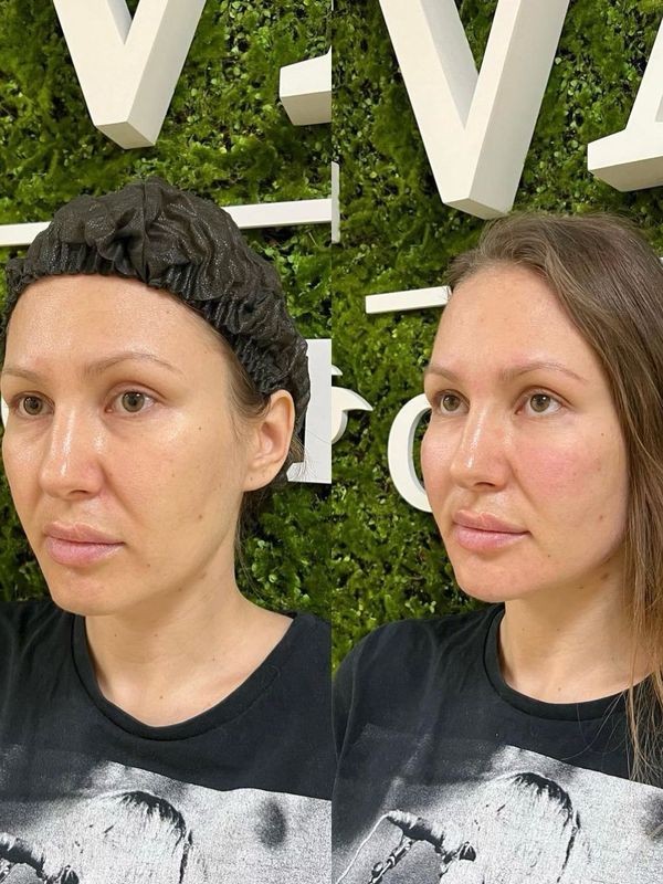 Без следов усталости Full face