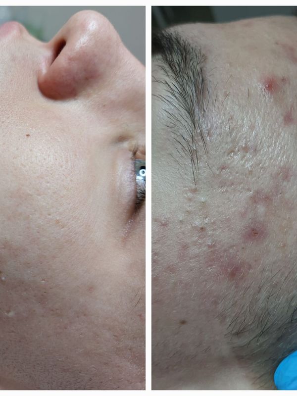Результат за 2 посещения