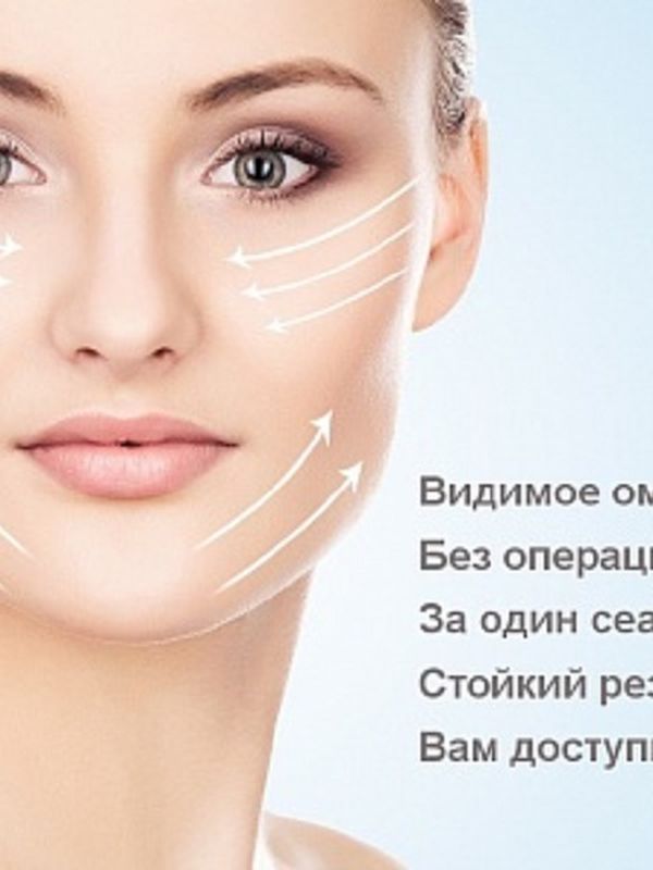 Смас лифтинг. Второй подбородок, подчелюстная область