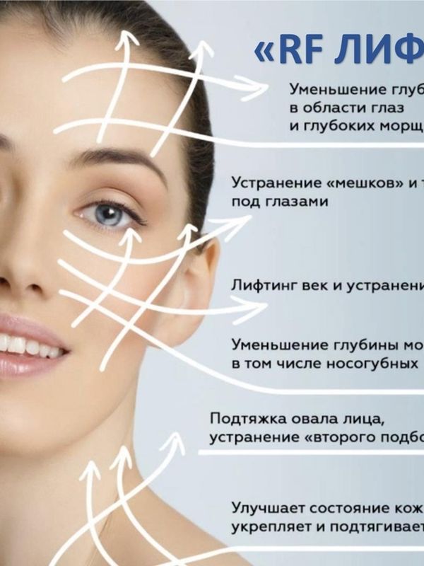 RF лифтинг лица и/или тела