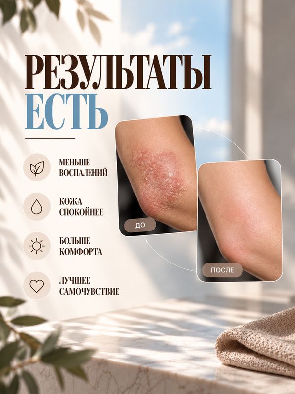 ПСОРИАЗУ НЕТ