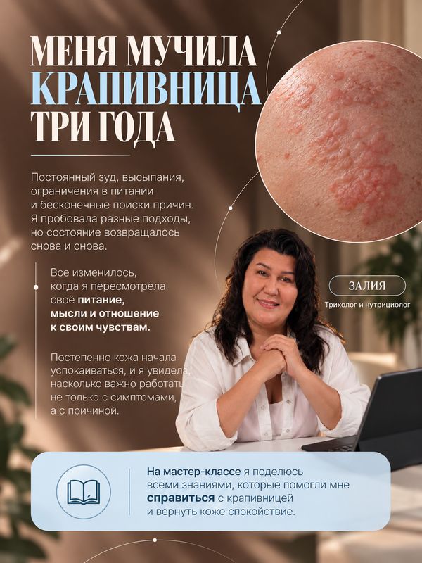 ПСОРИАЗУ НЕТ
