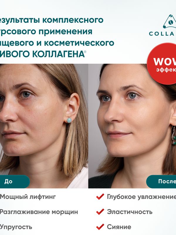 Крем для лица на основе ЖИВОГО КОЛЛАГЕНА. Увлажнение и лифтинг, 75 мл