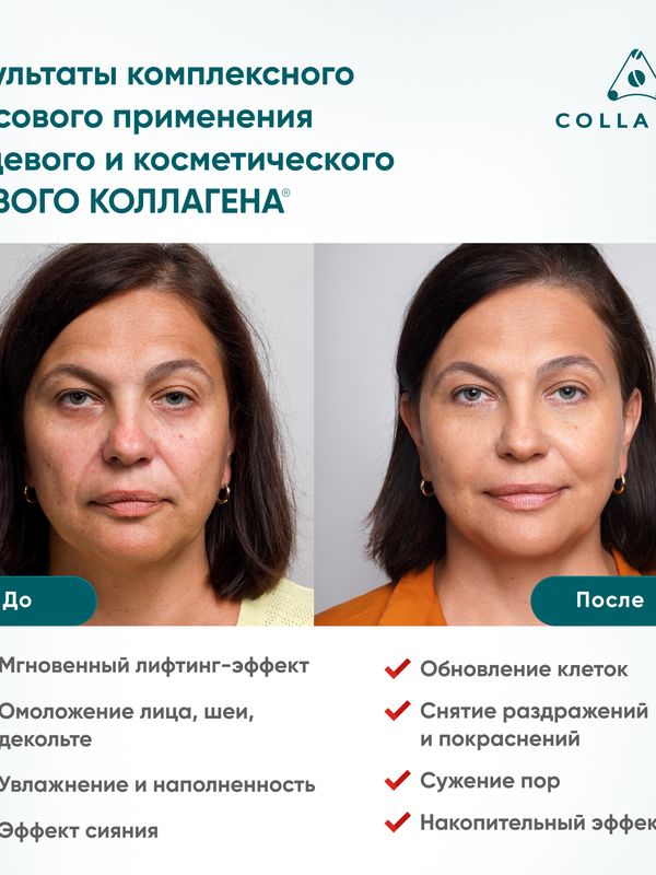 Биоктивная сыворотка на основе ЖИВОГО КОЛЛАГЕНА - 8 ампул по 2,5 мл