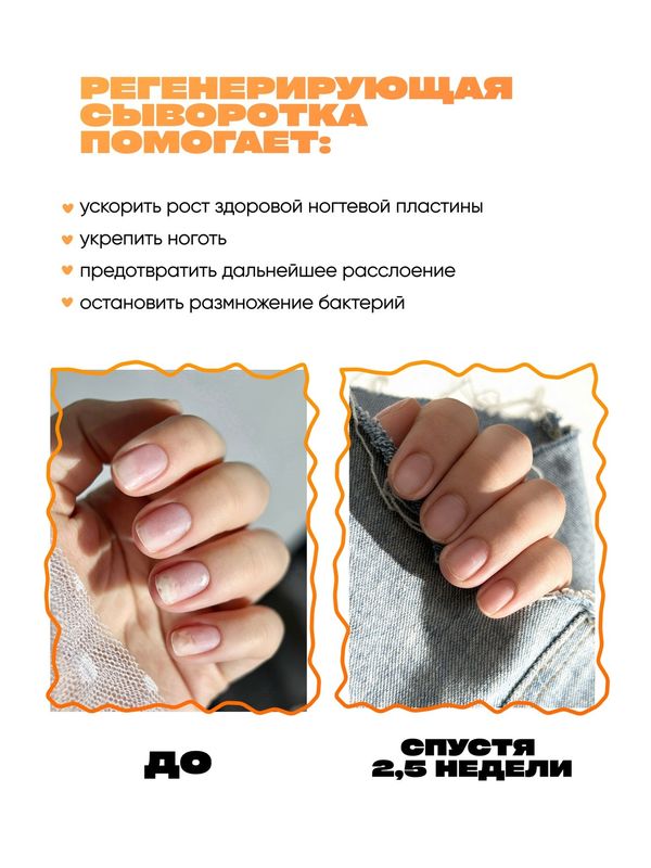 Сыворотка регенерирующая для ногтей при онихолизисе